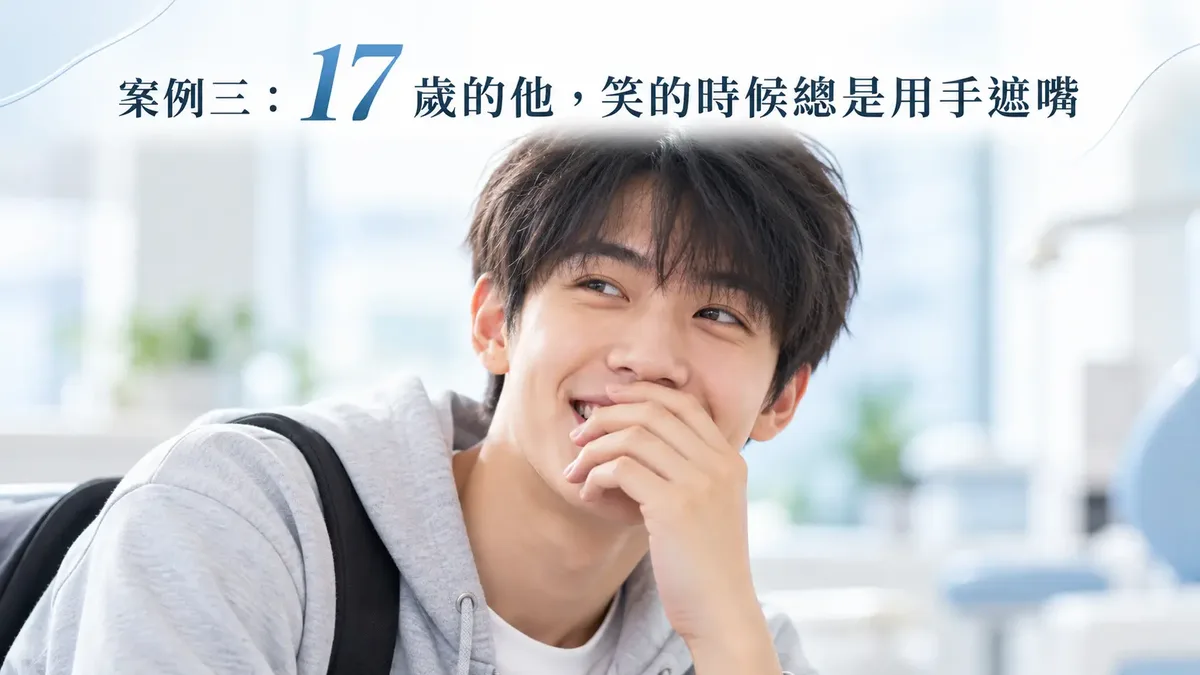 隱適美矯正暴牙：17 歲高中生案例示意